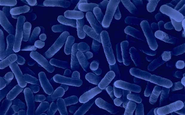 Scanned electron micrograph of Legionella pneumophila bacteria